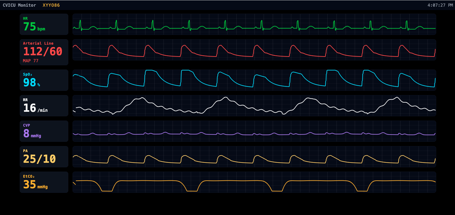ECG